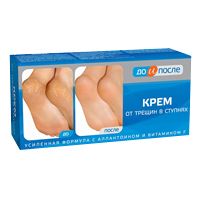 ДО И ПОСЛЕ лифтинг гель д/лица 50мл